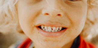 Examining whether fluoridation programs prevent severe caries