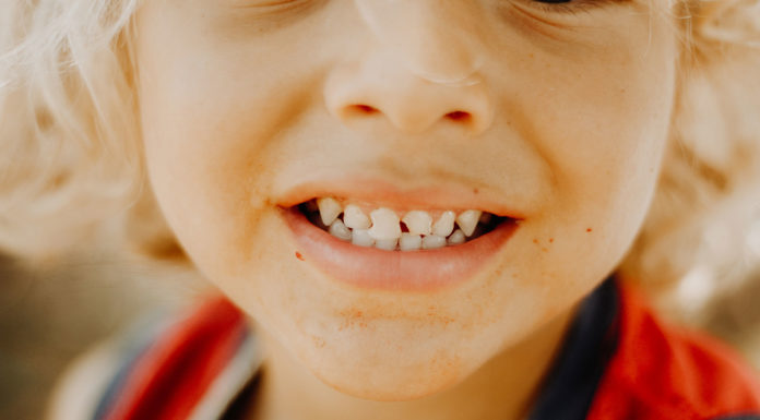 Examining whether fluoridation programs prevent severe caries
